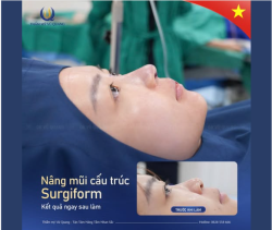 Nâng mũi đẹp ngay sau khi làm được không ??