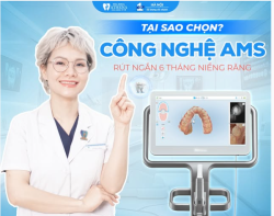 TẠI SAO NÊN CHỌN NIỀNG RĂNG CÔNG NGHỆ AMS? BÍ QUYẾT RÚT NGẮN 6 THÁNG CHỈNH NHA