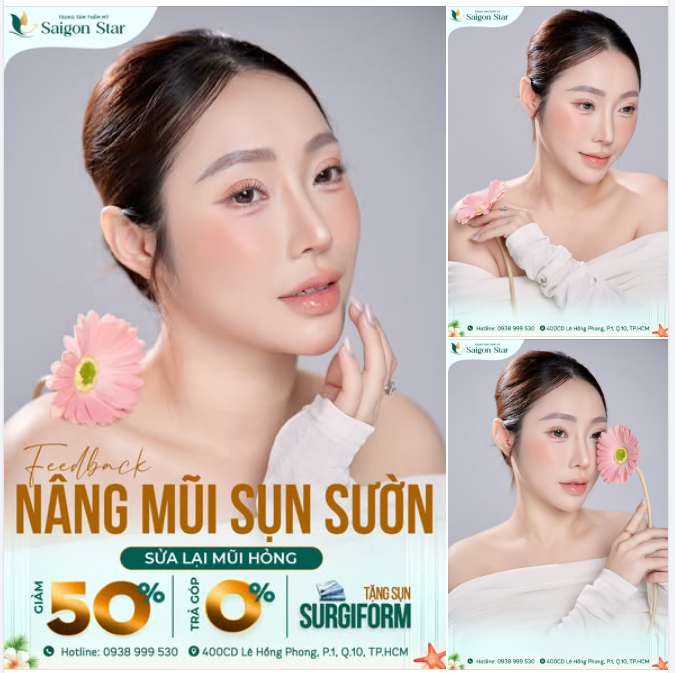 8 NĂM TRÔI QUA – DÁNG MŨI VẪN ĐẸP BỀN VỮNG NHƯ NGÀY ĐẦU