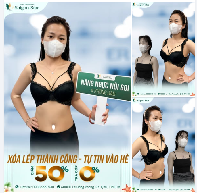 12 NGÀY THÀNH CÔNG XÓA SỔ "NGỰC LÉP"