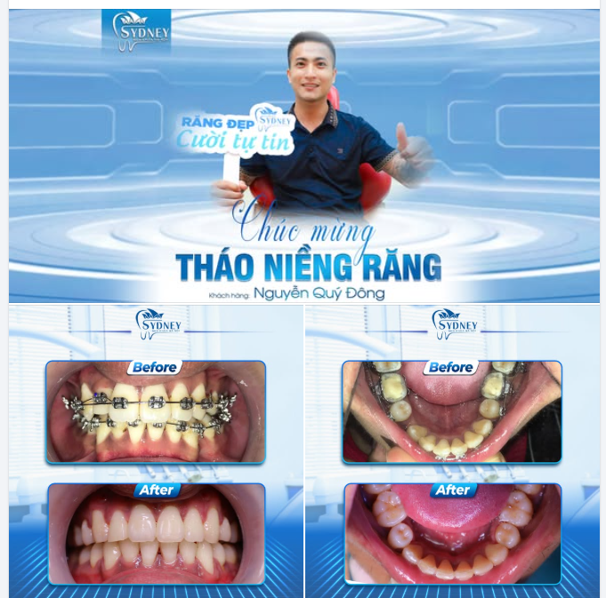 CHÚC MỪNG THÁO NIỀNG KH. QUÝ ĐÔNG