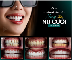 NỤ CƯỜI ĐỘC BẢN – KHẲNG ĐỊNH CHẤT RIÊNG