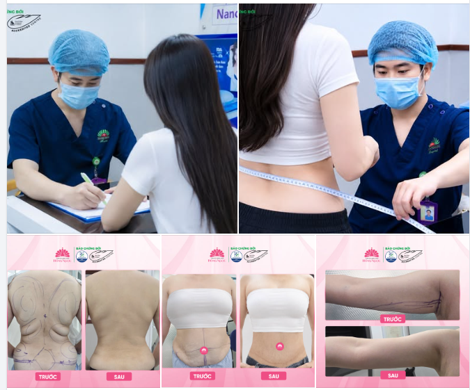“Mình thật sự bất ngờ vì cơ thể thay đổi rõ đến vậy chỉ sau 3 tháng, điều mình tiếc nhất là không làm sớm hơn.."