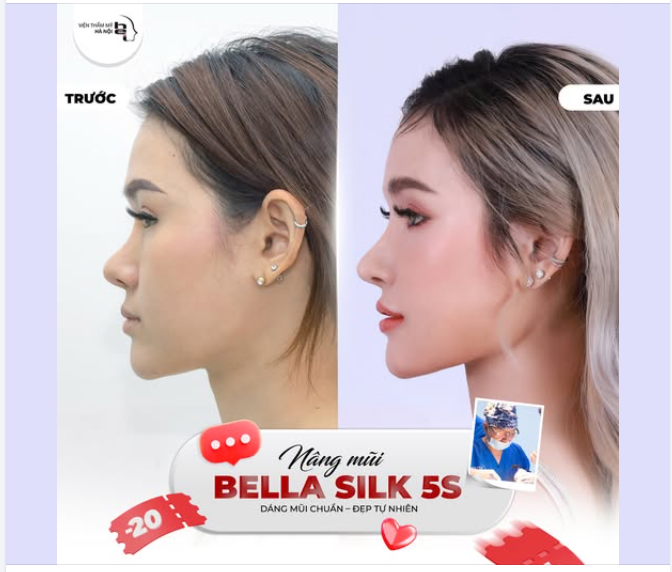 GÓC NGHIÊNG "CỰC PHẨM" – CHẲNG NGẠI CAMERA THƯỜNG VỚI BELLA SILK 5S