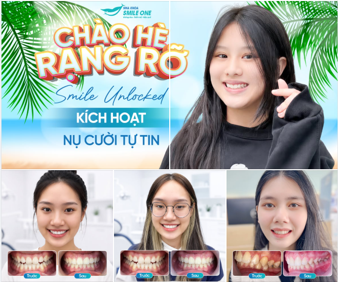 THÁNG 5 KHÉP LẠI – HÀNG CHỤC NỤ CƯỜI MỚI ĐƯỢC "MỞ KHÓA" TẠI SMILE ONE