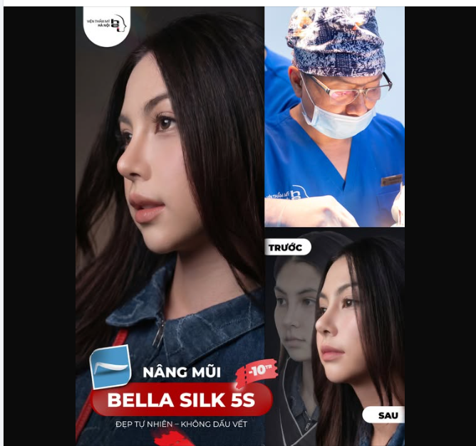 NÂNG MŨI BELLA SILK 5S  Mũi xinh - Điểm nhấn cho gương mặt thêm thu hút
