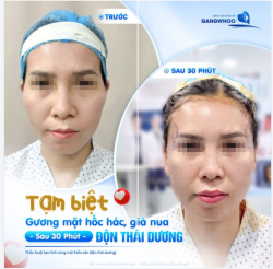 TẠM BIỆT GƯƠNG MẶT HỐC HÁC, GIÀ NUA