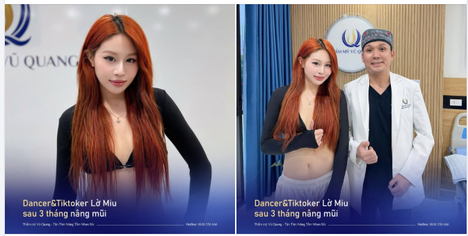 GẶP LẠI TIKTOKER LỜ MIU SAU 3 THÁNG NÂNG MŨI