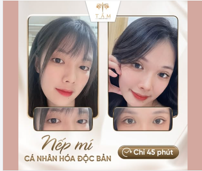 MÍ SỤP, DA CHÙNG khiến gương mặt kém tươi tắn?