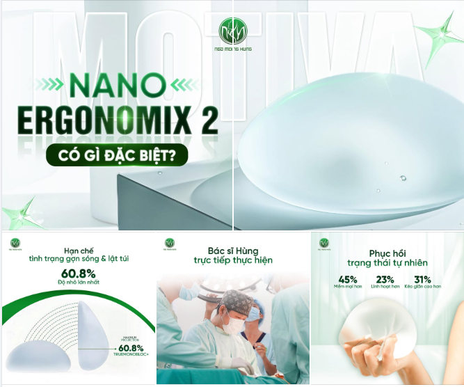 TÚI NGỰC THẾ HỆ MỚI ERGONOMIX 2® ĐÃ CÓ MẶT TẠI BV PTTM NGÔ MỘNG HÙNG!
