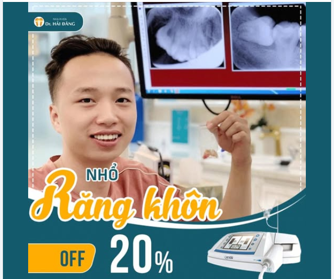 NHỔ RĂNG KHÔN OFF 20% – NHẸ NHÀNG - AN TOÀN - ÍT ĐAU