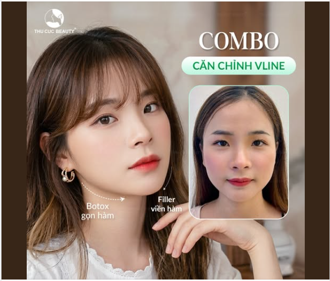 BÍ QUYẾT TẠO GÓC NGHIÊNG CHUẨN TỈ LỆ VÀNG VỚI "COMBO CĂN CHỈNH VLINE"