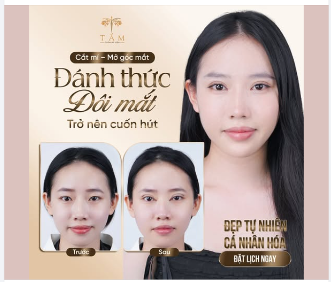 Một đôi mắt đẹp không chỉ giúp gương mặt sắc nét hơn, mà còn khiến thần thái thay đổi rõ rệt