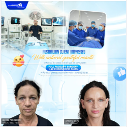 KHÁCH ÚC ẤN TƯỢNG VỚI KẾT QUẢ TRẺ ĐẸP TỰ NHIÊN SAU 14 NGÀY