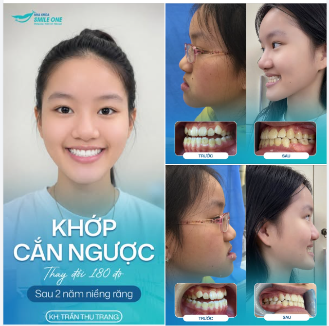 “EM KHÔNG NGHĨ SAU NIỀNG MÌNH CÓ THỂ THAY ĐỔI NHIỀU ĐẾN VẬY…”