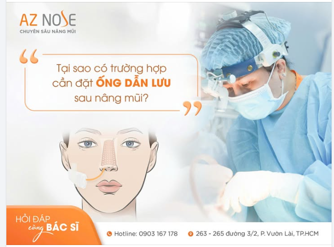 GIẢI ĐÁP VỀ "ỐNG DẪN LƯU" TRONG NÂNG MŨI