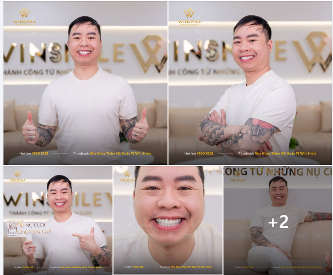 Anh Cường trở lại Win Smile tái khám với một năng lượng rạng rỡ đến mức chỉ nhìn thôi cũng đủ thấy anh đang hài lòng thế nào.