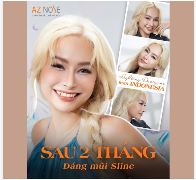 Việt kiều Indonesia tự tin khoe nhan sắc rạng rỡ chỉ sau 2 tháng nâng mũi