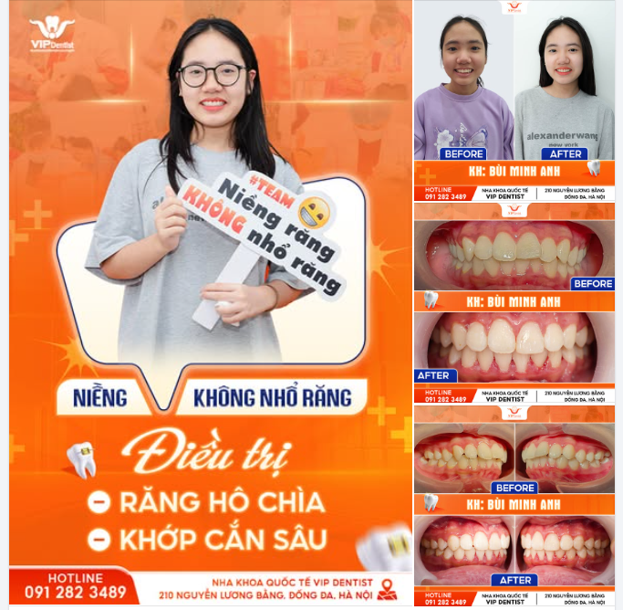 "SAY BYE" RĂNG HÔ CHÌA, "SAY HI" NỤ CƯỜI TOẢ SÁNG CÙNG CÔ BÉ MINH ANH!