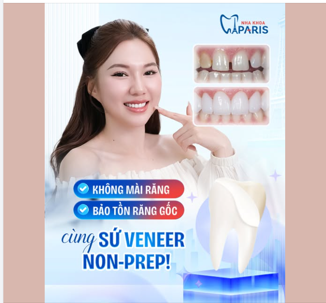 KHÔNG MÀI RĂNG – BẢO TỒN RĂNG GỐC - NÂNG TẦM NỤ CƯỜI CÙNG SỨ VENEER NON-PREP!