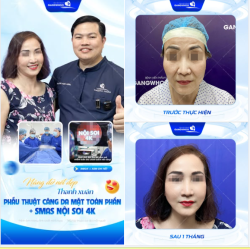 NÂNG ĐỠ NÉT ĐẸP THANH XUÂN