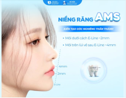 KIẾN TẠO "GÓC NGHIÊNG THẦN THÁNH" CÙNG CÔNG NGHỆ NIỀNG RĂNG AMS