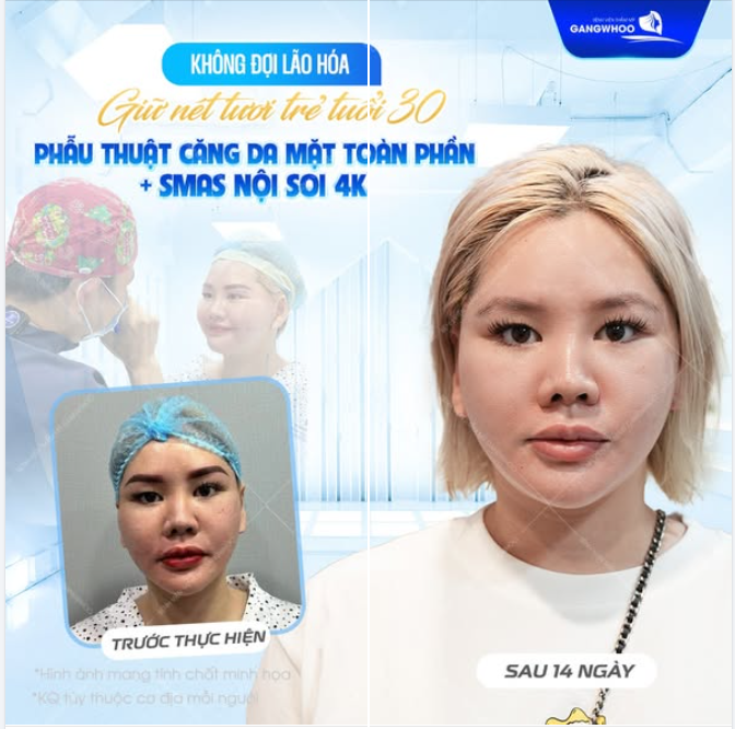 DUY TRÌ NÉT TƯƠI TẮN Ở TUỔI 30 THEO CÁCH RIÊNG