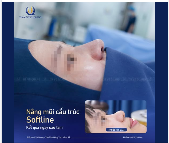 Mũi tẹt, mũi cà chua bất lợi đủ đường?