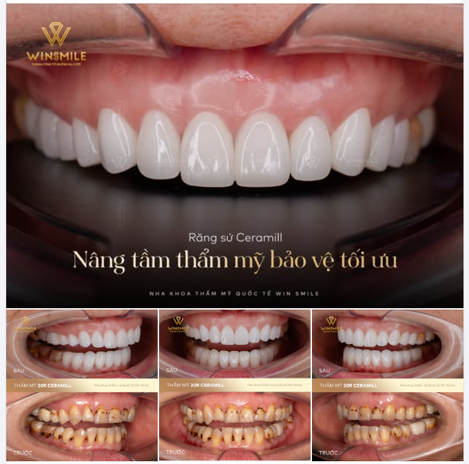 NÂNG TẦM THẨM MỸ, BẢO VỆ TỐI ƯU