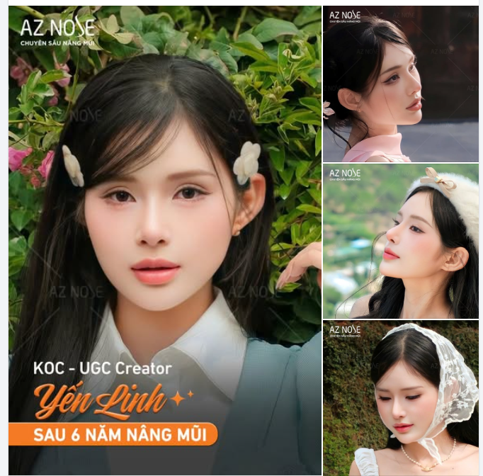 Tạm biệt dáng mũi mất cân đối do t..iêm filler, KOC Yến Linh ngày càng thần thái, tự tin "cân" mọi góc máy sau 6năm nâng mũi cấu trúc.