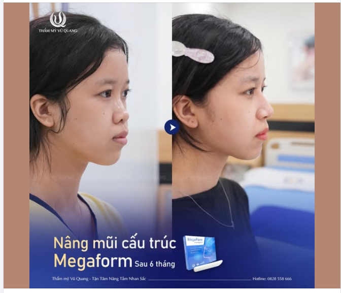 Không cần makeup cầu kỳ.  Không cần filter quá tay.