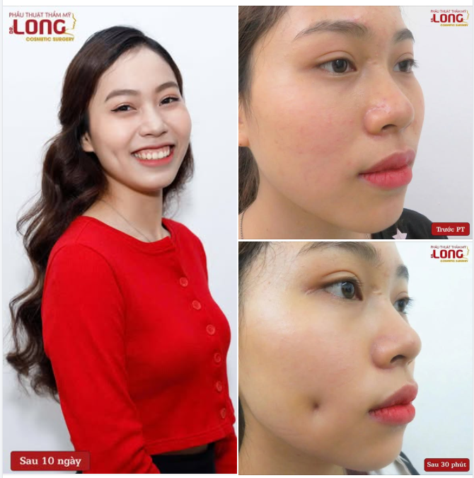 NÉT NHỎ TẠO HIỆU ỨNG TO  Anh chị em nào cũng thích sở hữu.