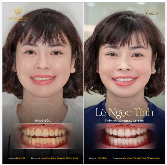 CÓ NHỮNG NỤ CƯỜI ĐÃ "NGỦ QUÊN" QUÁ LÂU...
