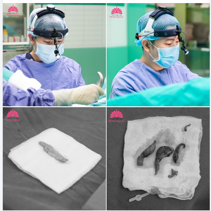 TOP DỊCH VỤ THẨM MỸ ĐƯỢC CHỊ EM SAU SINH LỰA CHỌN NHIỀU NHẤT