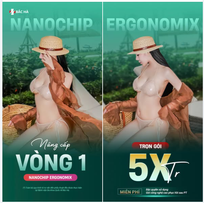 QUÀ TẶNG THÁNG 5 NÂNG NGỰC NANOCHIP ERGONOMIX CHỈ TỪ 5XTR TRỌN GÓI