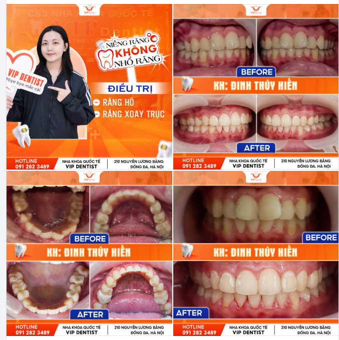 CHỈ 1 CHÚT THAY ĐỔI CŨNG LÀM BẠN THẤY TỰ TIN HƠN!