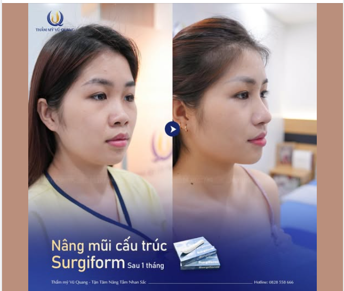 Khác quá đúng không cả nhà...