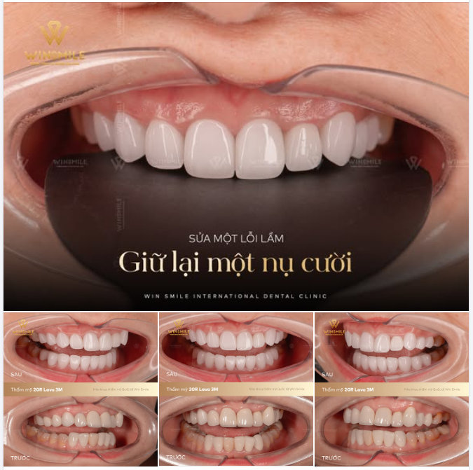 SỬA MỘT LỖI LẦM, GIỮ LẠI MỘT NỤ CƯỜI
