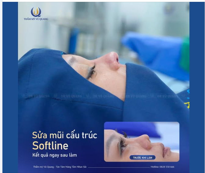 Nâng mũi hỏng đang trở thành tình trạng đáng báo động khi ngày càng nhiều khách hàng gặp biến chứng sau làm đẹp tại các cơ sở kém uy tín.