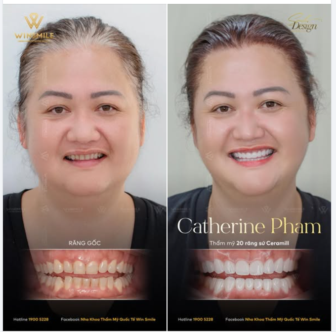 Đẹp tự nhiên nhưng không tự nhiên mà đẹp, khi biết đầu tư và chăm chút cho diện mạo của mình, chắc chắn bạn sẽ có được những thành quả xứng đáng.