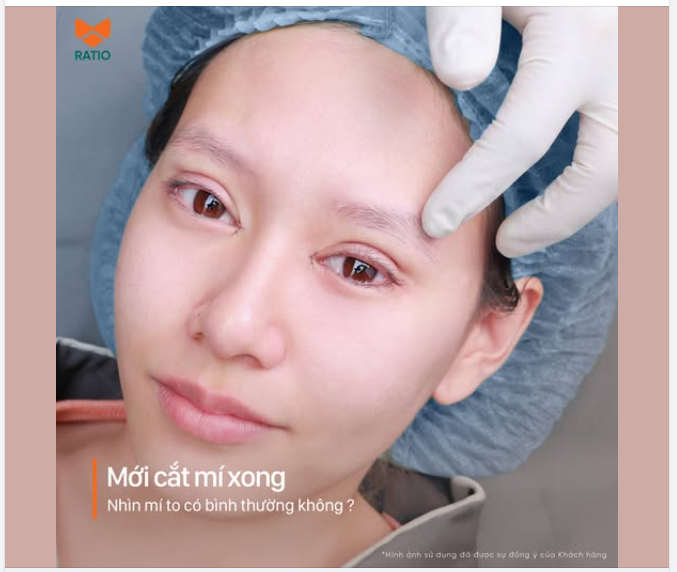 “Bác ơi… sao mới làm xong mà mí nhìn còn to quá vậy?”