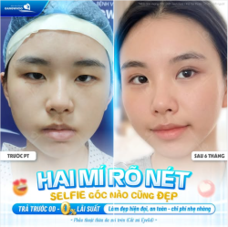HAI MÍ RÕ NÉT, SELFIE GÓC NÀO CŨNG ĐẸP