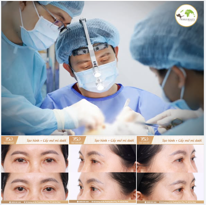 U60 nhưng nhìn lúc nào cũng mệt mỏi chỉ vì một vị trí đã “tố cáo” tất cả.