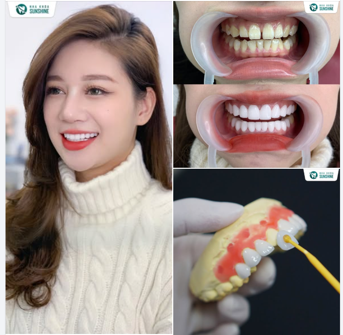 KHÔNG CHỈ LÀ NỤ CƯỜI ĐẸP - ĐÓ LÀ KHỞI ĐẦU CỦA NHỮNG THÀNH CÔNG MỚI