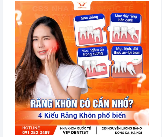 RĂNG KHÔN CÓ CẦN NHỔ? ĐỪNG ĐỂ "CƠN ĐAU" TRỞ THÀNH NỖI ÁM ẢNH!