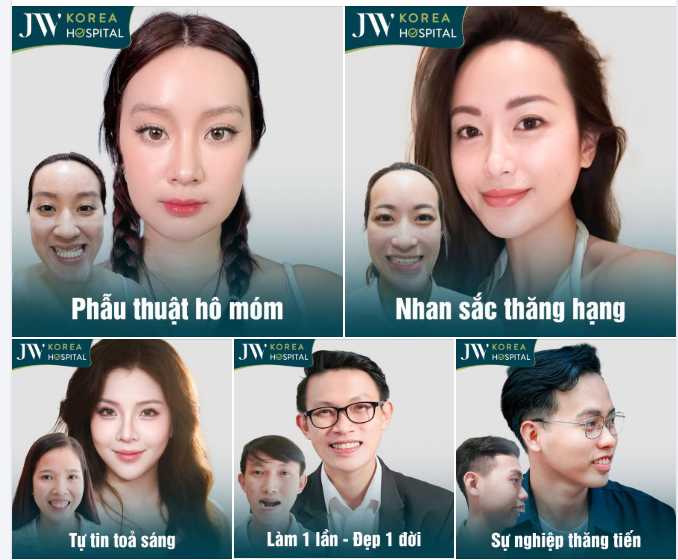 THAY MẶT ĐỔI VẬN: TOP 5 CA TÁI SINH NGOẠN MỤC SAU PHẪU THUẬT HÀM TẠI JW