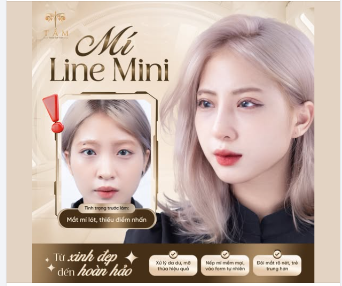Chỉ một thay đổi nhỏ nhưng đủ khiến gương mặt hài hòa và có thần thái hơn