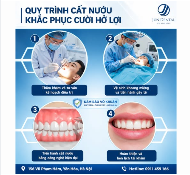 QUY TRÌNH CẮT NƯỚU KHẮC PHỤC CƯỜI HỞ LỢI AN TOÀN – THẨM MỸ