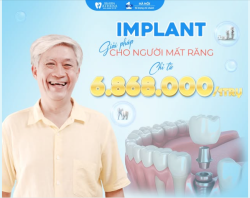 TRỒNG RĂNG IMPLANT - GIẢI PHÁP HOÀN HẢO CHO NGƯỜI MẤT RĂNG CHỈ TỪ 6.868.000Đ/TRỤ