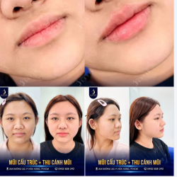 GẤP ĐÔI SỰ XINH ĐẸP CHỈ TRONG 1 LẦN TỚI LÀM ĐẸP TẠI LATIN